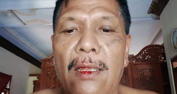 Andi-Wijaya-Korban-penganiayaan-875-620x330